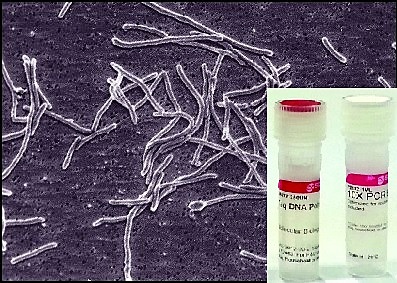 Taq Polimerasa: Thomas Brock y Hudson Freeze