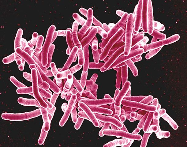 Bacilo de Koch (Mycobacterium tuberculosis).