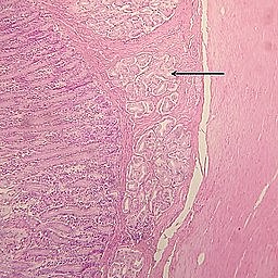 Brunner - Glándulas duodenales.