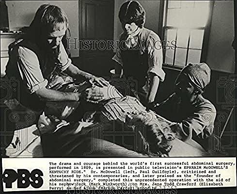 Primera resección de un quiste de ovario.