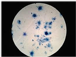 Antibiótico Eritromicina.