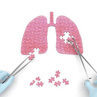 Timeline: Historia Cirugia Toracica