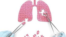 Timeline: Historia Cirugia Toracica