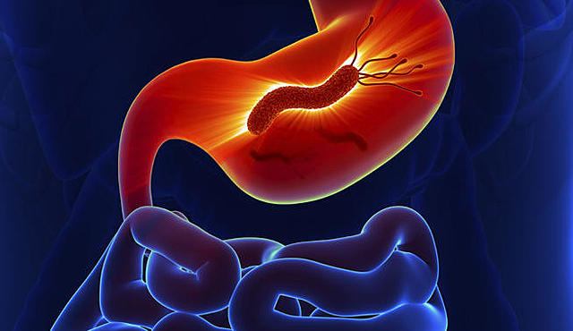 ¡Auch, mi estómago!