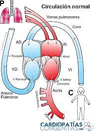 Circulación extracorporea