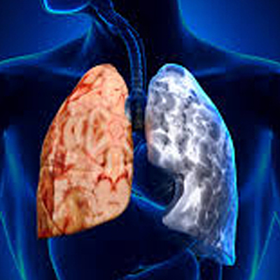 Timeline: HISTORIA DE LA CIRUGIA DE TORAX LATINOAMERICANA