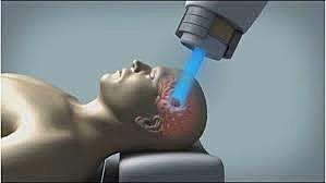 El primer haz de protones