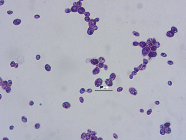 Tinciones para observar bacterias