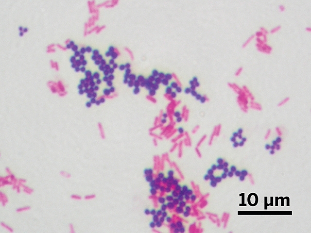 Tinción diferencial de Gram.