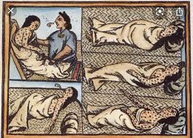 Small Pox Begins Spreading to Native Americans