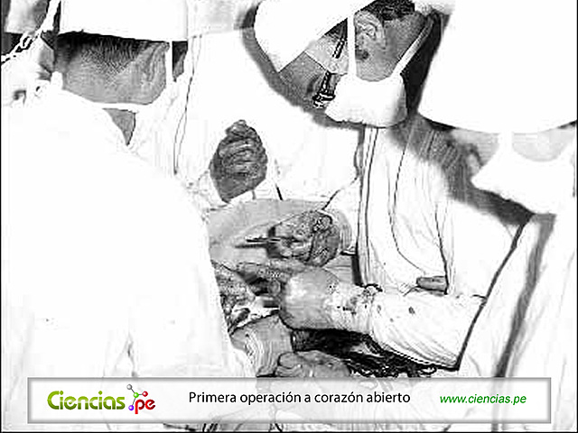 Primera cirugía a corazón abierto