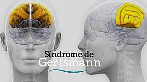 Las alteraciones del lenguaje escrito