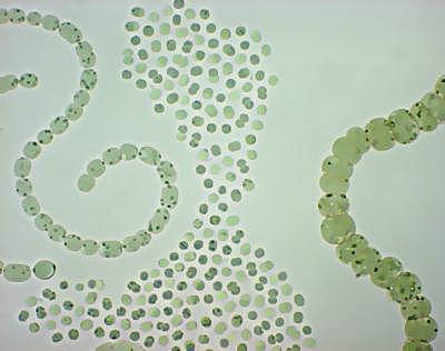 Proliferation of Cyanobacteria