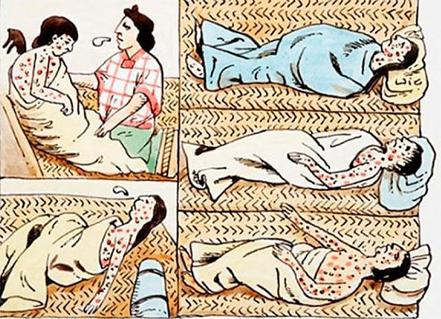 PRIMERA GRAN EPIDEMIA DE VIRUELA