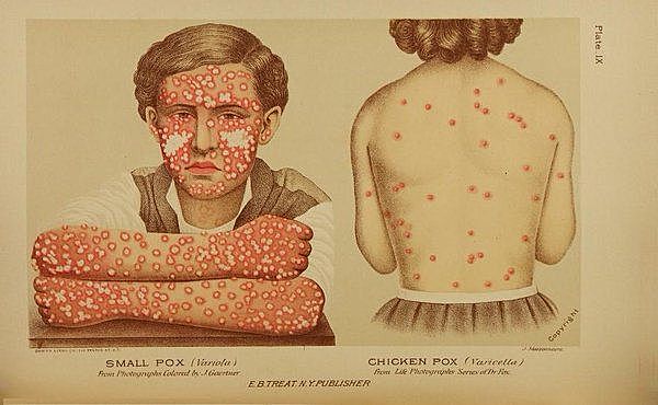 Eradication of Smallpox