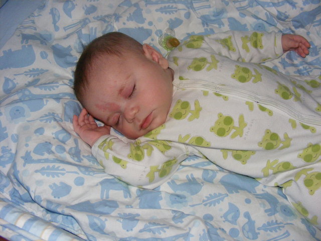 Rolled on side during sleep