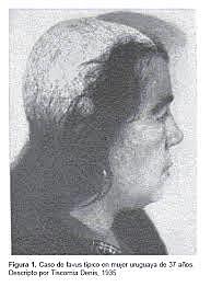 Aulus Cornelius Celsius