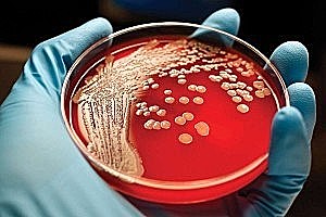 Los medios de cultivo.