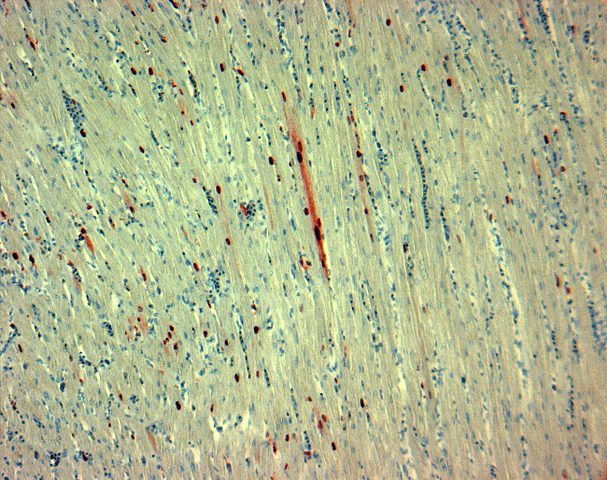 Influenza A virus subtype H7N3