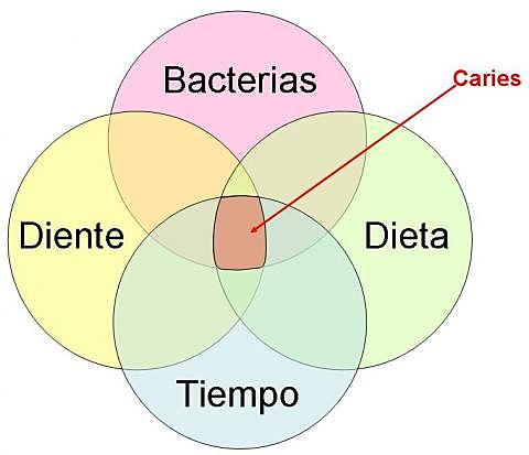 Causa de la caries dental