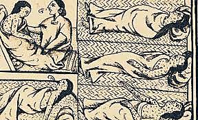 Epidemia del sarampión