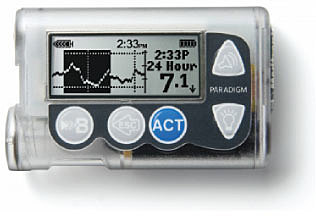 BOMBA EXTERNA DE INSULINA
