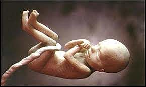 Meissner atribuye la recurrencia de casos de DTN a factores nutricionales