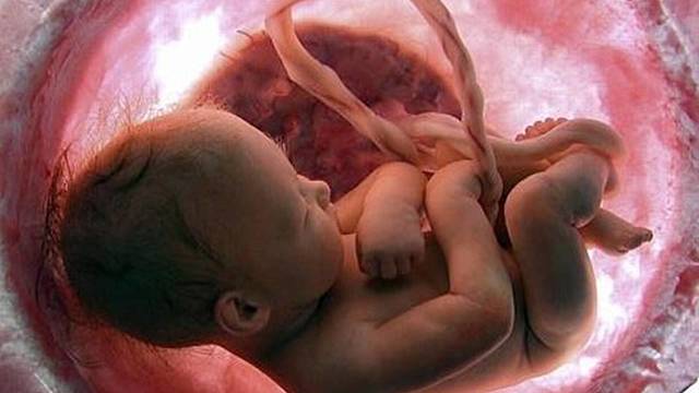 Embrión humano.
