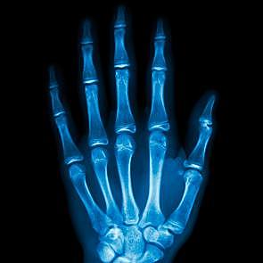 Willhelm Conrad Röntgen