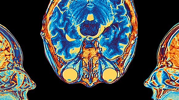 Gestalt Theory, 1886