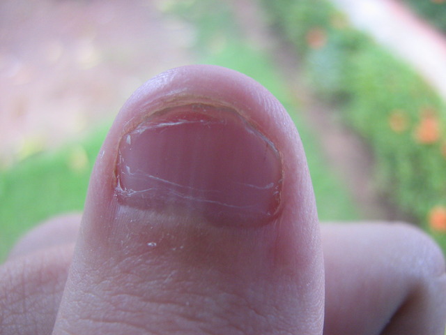 Descubro el fuego (me quemo el dedo)