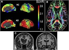 Ciencia: impacto de las técnicas de neuroimagen funcional en el desarrollo de las neurociencias por Logatt y Castro