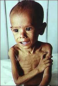 Primera encuesta nutricional en México