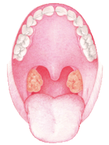 where are my tonsils?