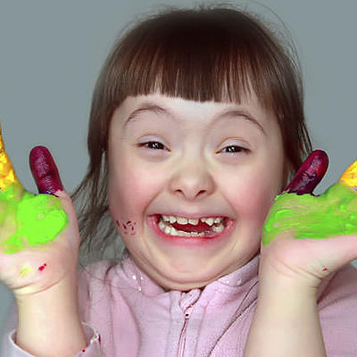 Timeline: Síndrome de Down