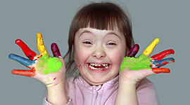 Timeline: Síndrome de Down