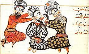 Albucasis explico la relación entre el cálculo y la enfermedad