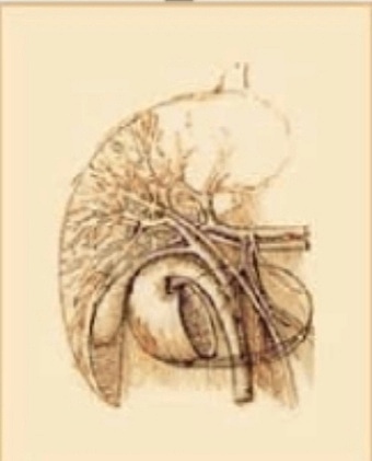 Ateroesclerosis y cirrosis de hígado