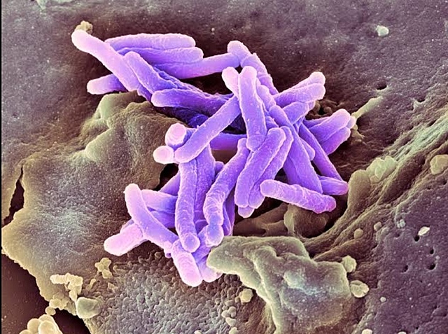 Descubrimiento del Bacilo de la Tuberculosis