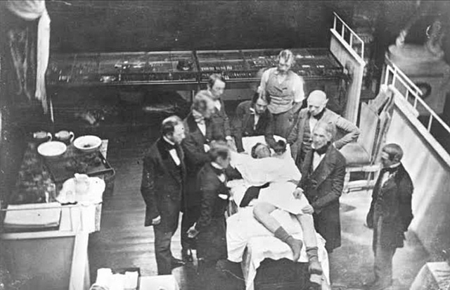 Primera operación con anestesia