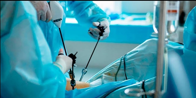 Cirugía Laparoscópica