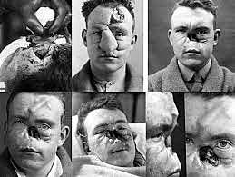 Slik slutter 1.verdenskrig