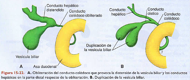 Semama 4-5: Higado y vesicula biliar: