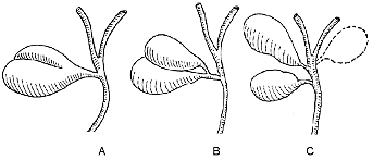 Anomalías del hígado y vesícula biliar