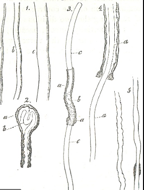 Albrecht von Roelliker