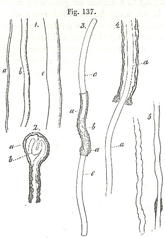 Albrecht von Roelliker