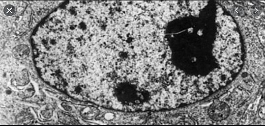 Albrecht von Roelliker discovers sperm and eggs are made of cells.