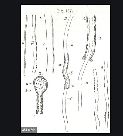 Albrecht von Roelliker