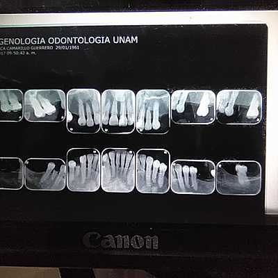 Timeline: cronologia de erupcion