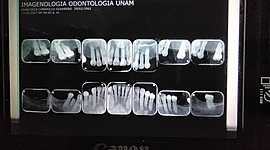 Timeline: cronologia de erupcion